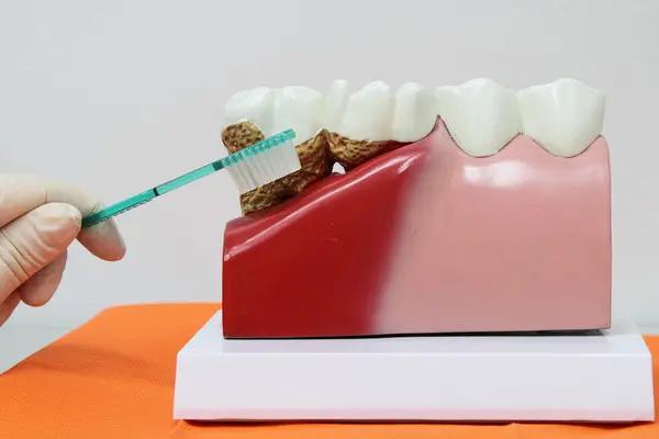 歯がボロボロの治療費用を紹介｜治療費を払えない対処方法は？