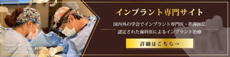 前歯はインプラントとブリッジどっちがいい?後悔しない選び方をわかりやすく解説